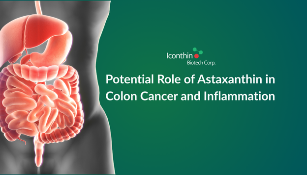 Astaxanthin and Colon Cancer: A Review of Emerging Scientific Research
